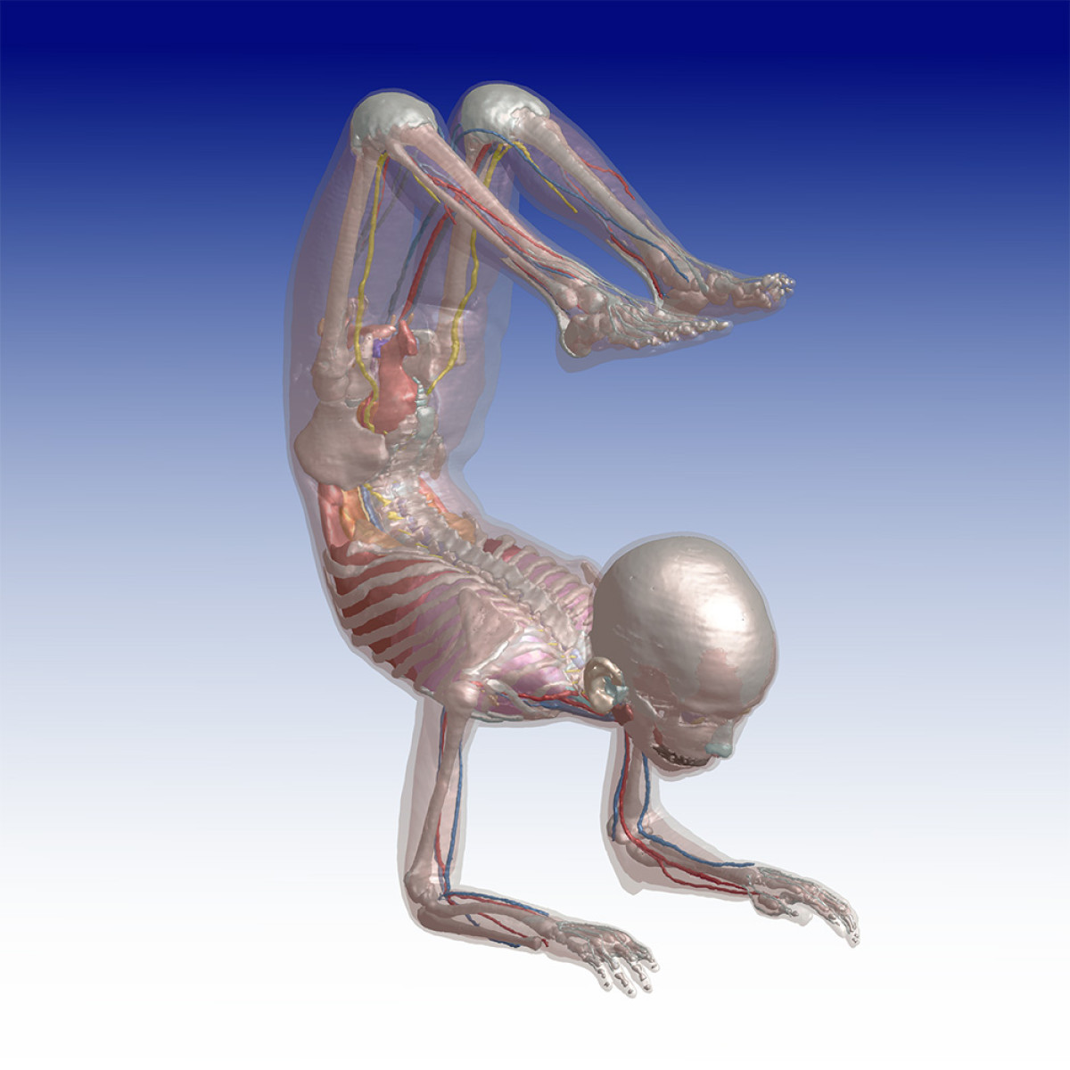 Improved Posability in Upgraded ViP Models » zurich med tech