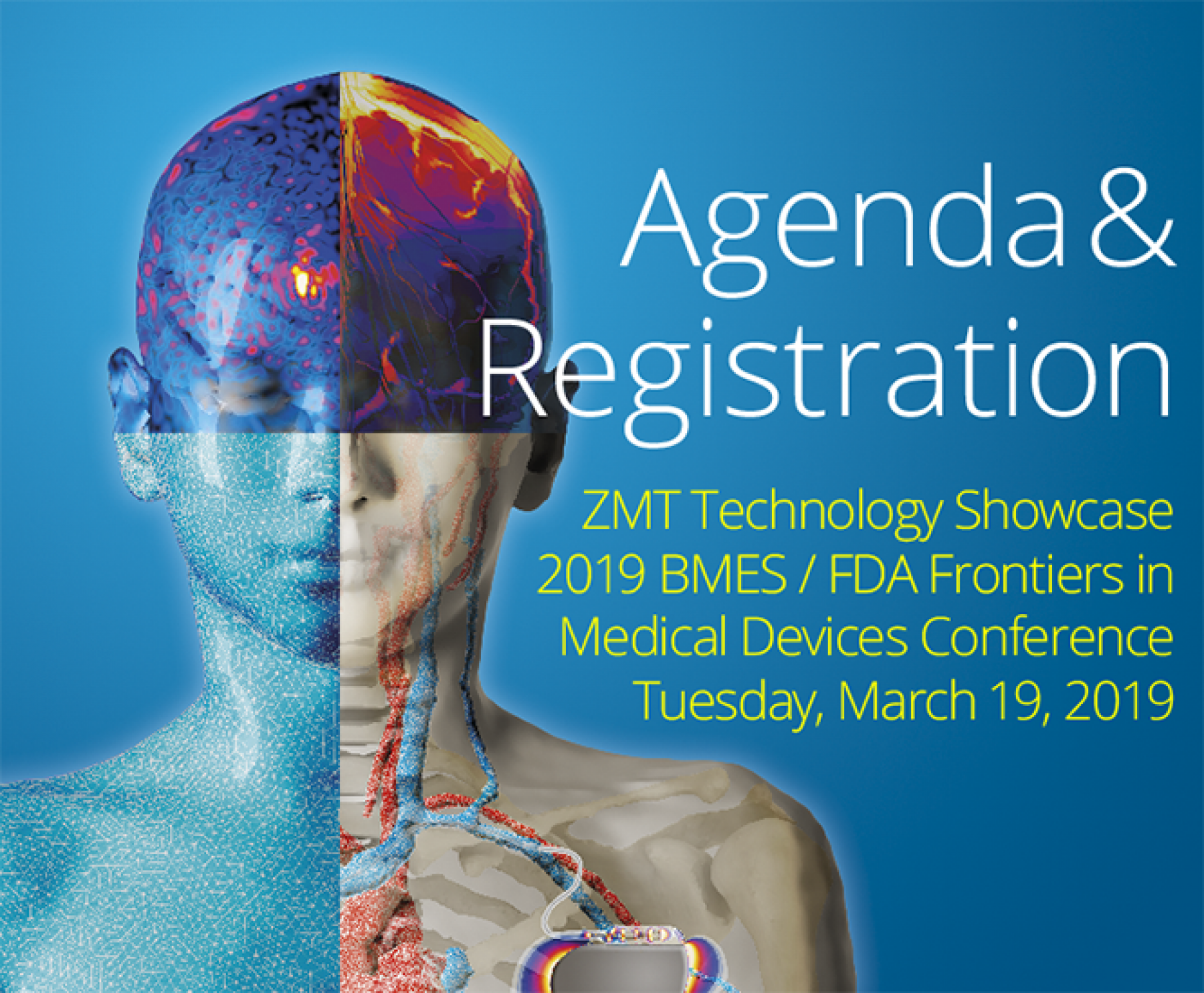 ZMT 2019 Frontiers in Medical Devices Conference » zurich med tech